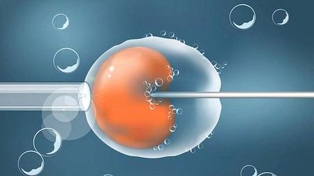 人工授精一般几次成功？为什么不建议做人工授精？