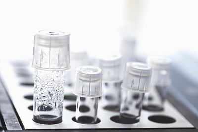 鲜胚移植第3天什么感觉都没有了，是不是正常的现象？